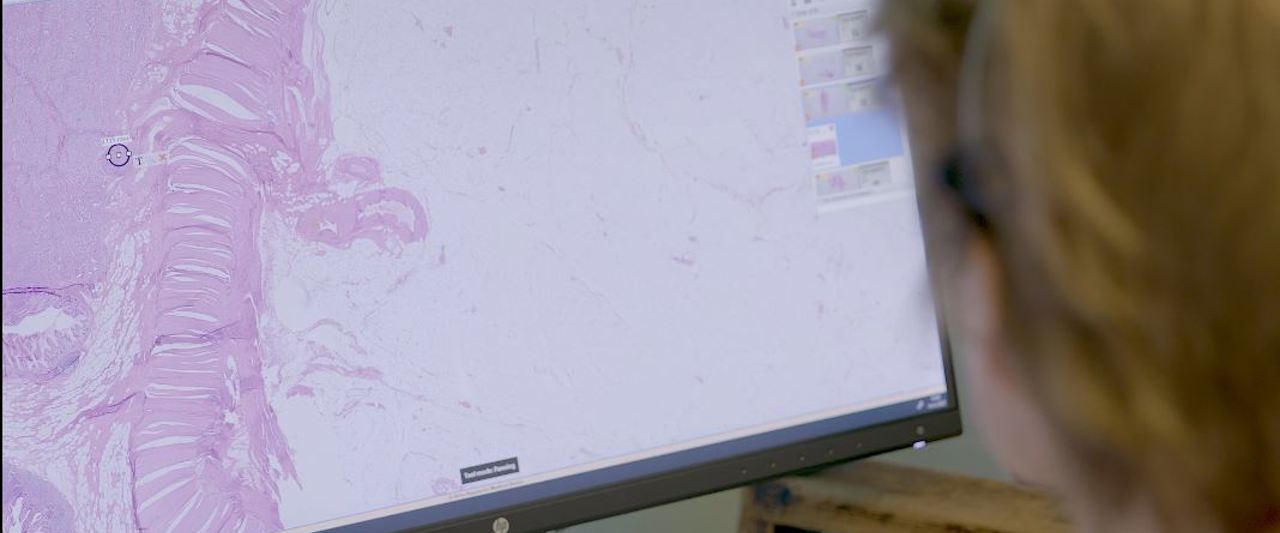 Still afdelingsfilm NET