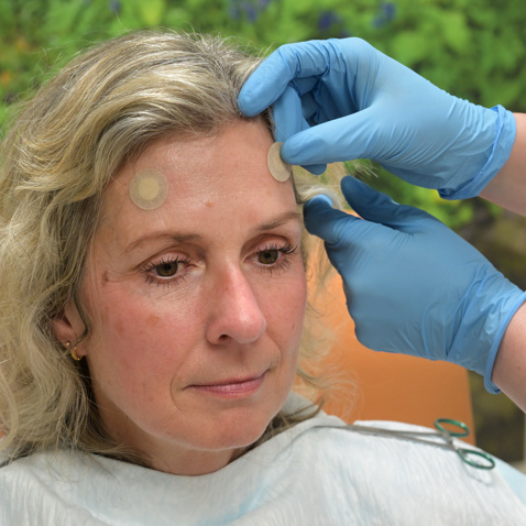 Gamma Knife 20241213 06