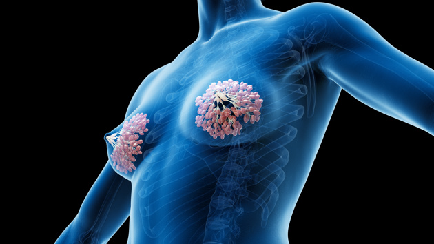 Adobestock 548001428