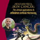 Banner AVL Promotie Yannick Elshot