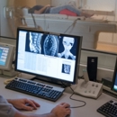 Beeldvormend Hersenen