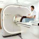 PSMA PET/CT Scan
