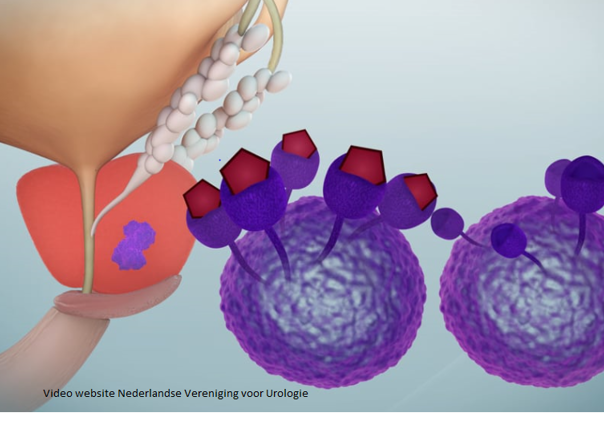 still video hormoontherapie verenging voor urologie