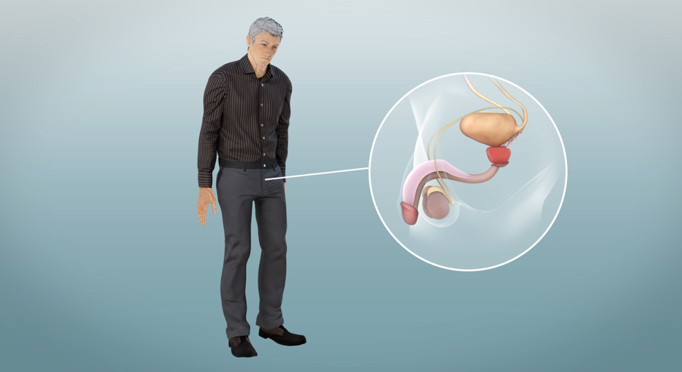 videostill animatie hormoontherapie porstaatkanker NVU