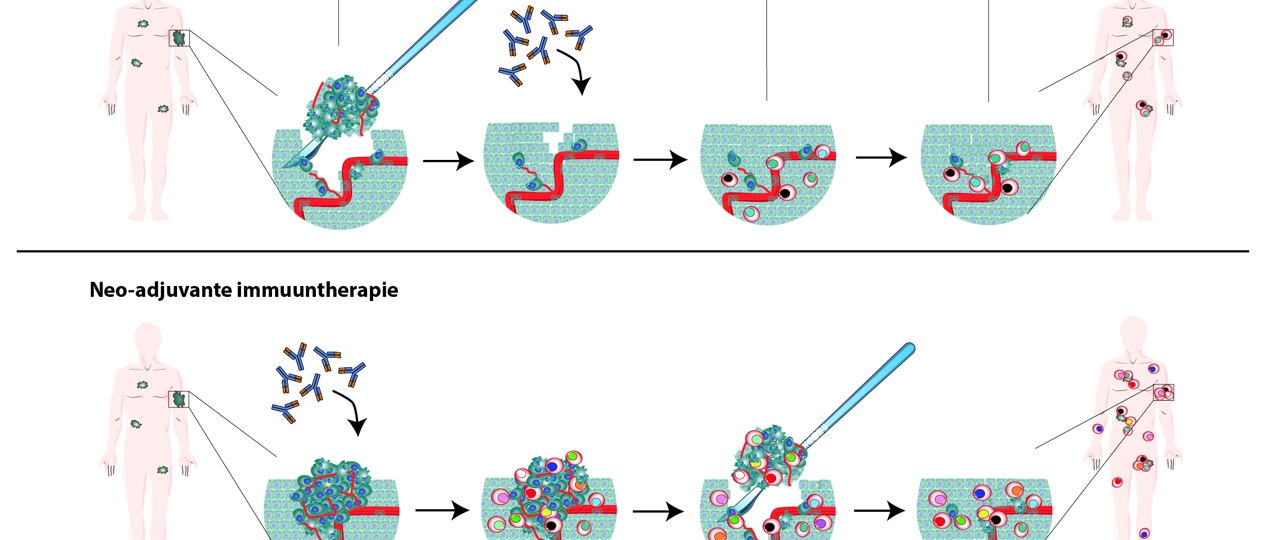 Illustratie Neo Adjuvante Immuuntherapie C Jacqueline Staring NL