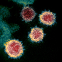 Novel Coronavirus SARS Cov 2 Wikimedia