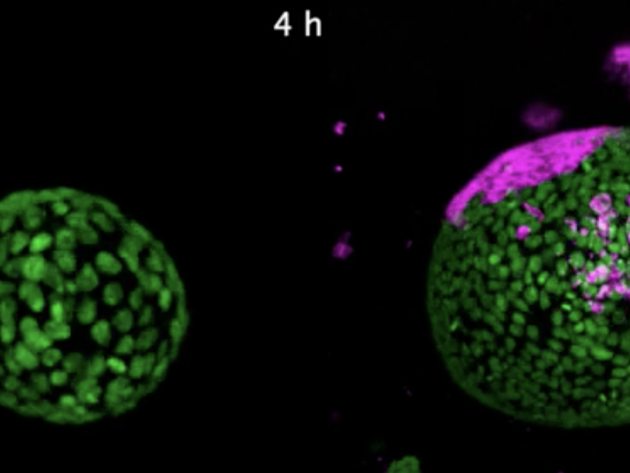 Video Darmkanker Foto