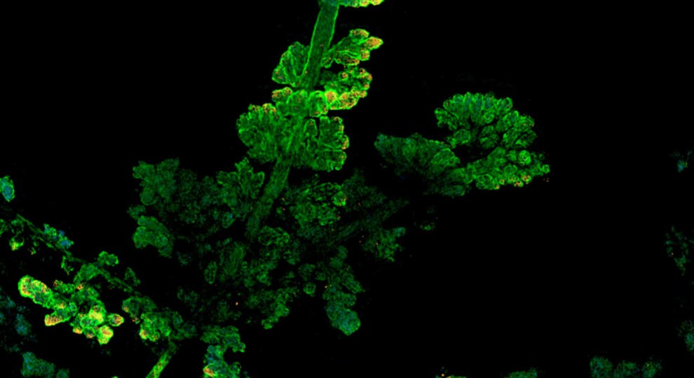 Nr 2A Pulvermillie Imagecontest Cleaned Scaled Bicubic Sm