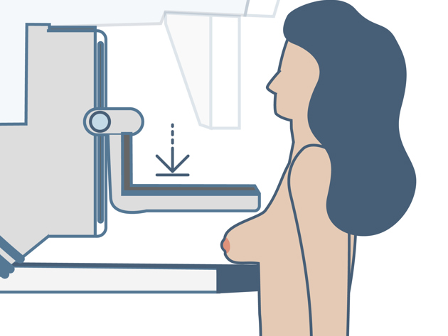 Illustratie mammografie 2