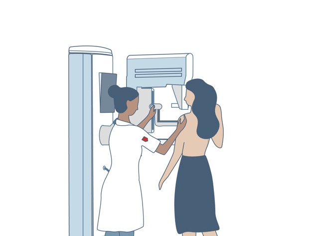 Illustratie mammografie 1