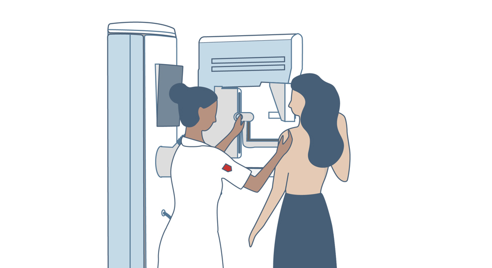 Illustratie mammografie 1
