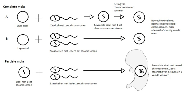 Wat Is Een Mola Zwangerschap