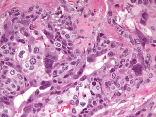 Trofoblast 5 Voorhetgesprek Microscoop