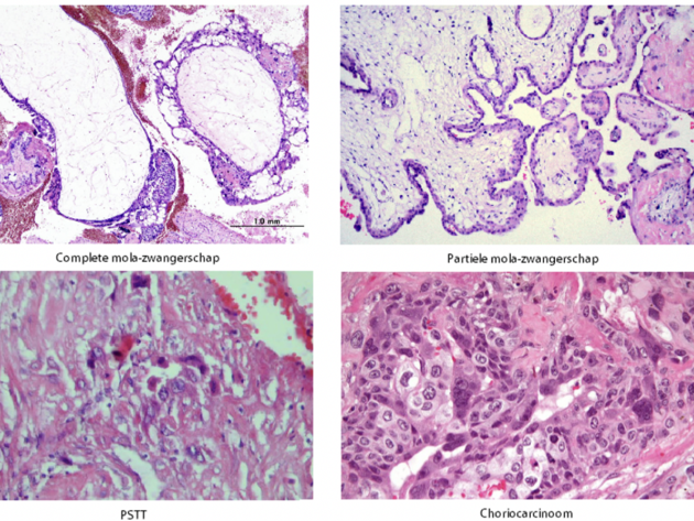 Trofoblast Voorhetgesprek 1 Microscoop