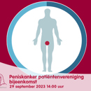 Peniskanker Patientenvereniging Bijeenkomst Liggend