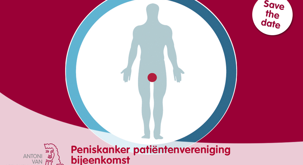 Peniskanker Patientenvereniging Bijeenkomst Liggend