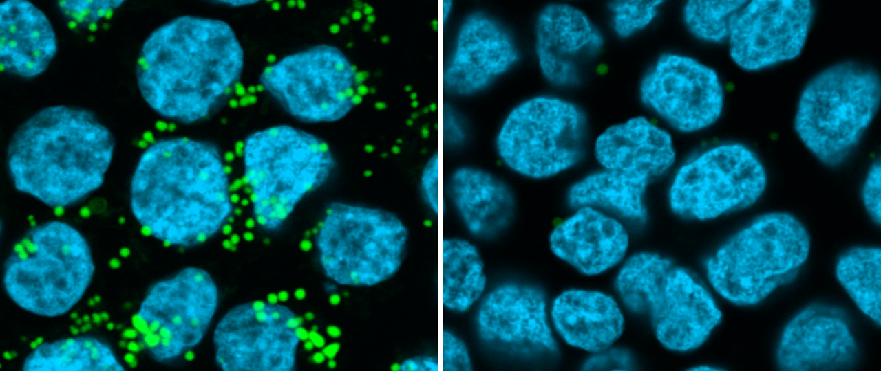 TMX1 Knockout HAP1 Cells Zonder Tekst