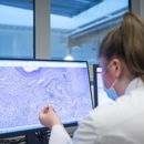 5. Primaire Tumor Onbekend Beeld