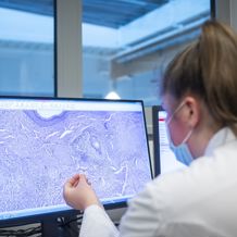 5. Primaire Tumor Onbekend Beeld