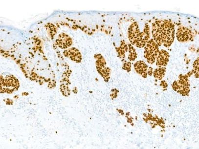 Sox 10 Ihc