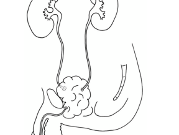 Neoblaas Schema