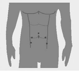 Afbeelding3prostaatfolder