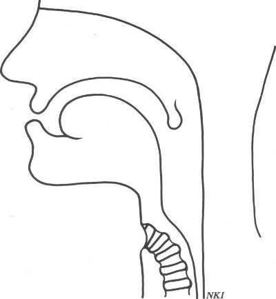 tracheostoma