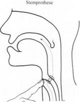 NSvG_sheet stemprothese.jpg