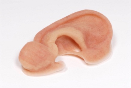 oorprothese[1]