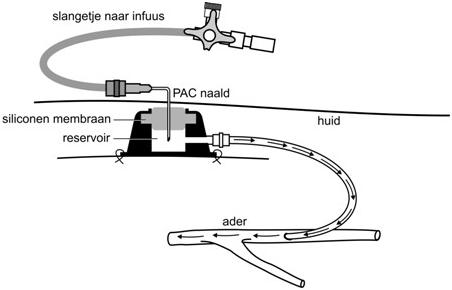 https://www.bernhoven.nl/media/w1pg1dnt/port-acat2.jpg