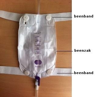 C:\Users\c.halff\Desktop\beenbanden.jpg