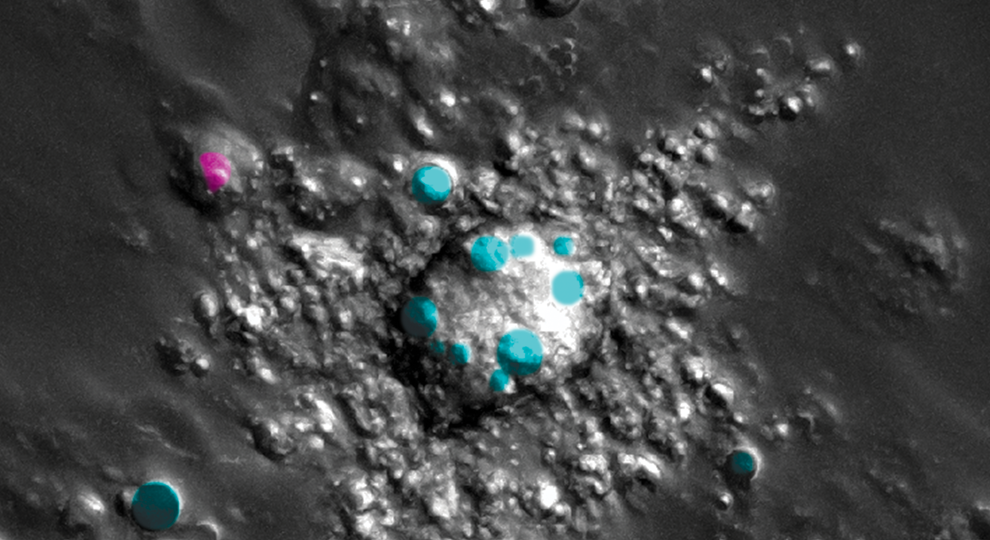 Mogelijk aangrijpingspunt gevonden voor behandeling helft van alle kankers