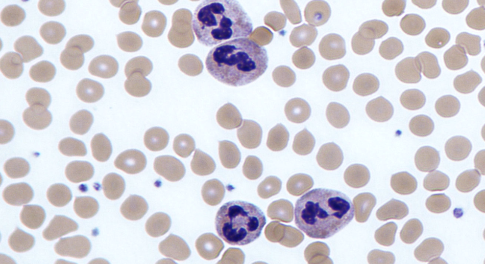 Foto Neutrophils Kdv