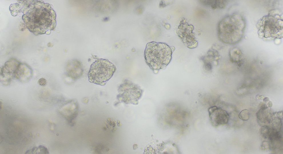 Organoids