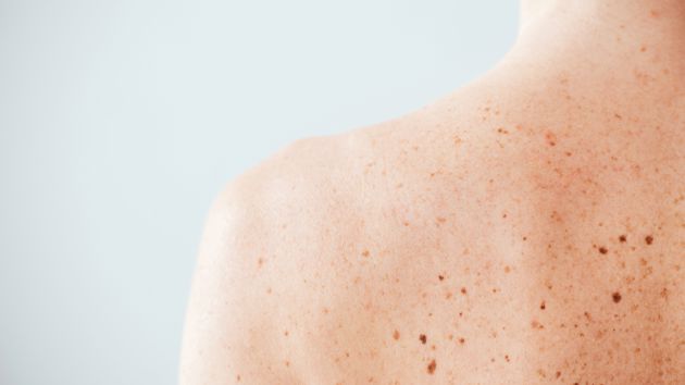 Adobestock 264437586